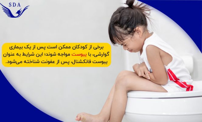 علت یبوست نوزادان و کودکان