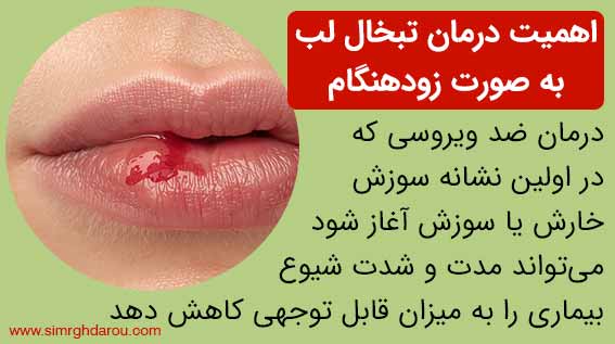 اهمیت درمان تبخال لب به صورت زودهنگام