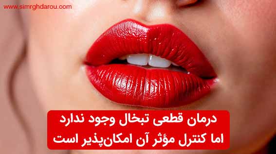 درمان تبخال لب