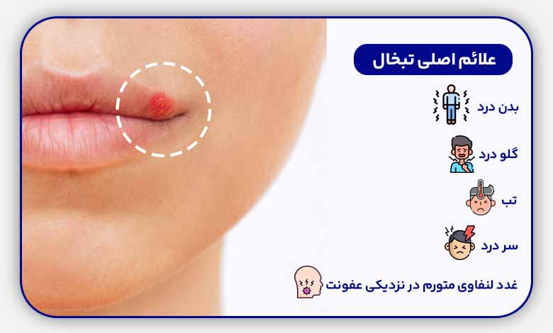 درمان تبخال لب