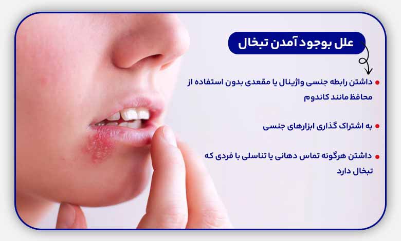 درمان تبخال لب