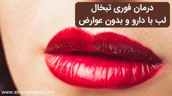 درمان فوری تبخال لب با دارو و بدون عوارض