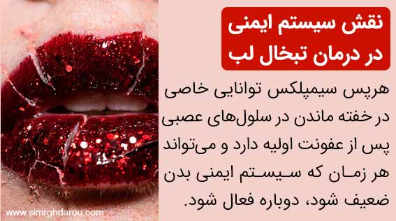 نقش سیستم ایمنی در درمان تبخال لب